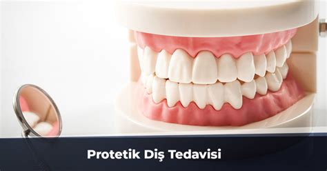 Protetik Diş Tedavisi: Başarı Oranları ve Beklentiler