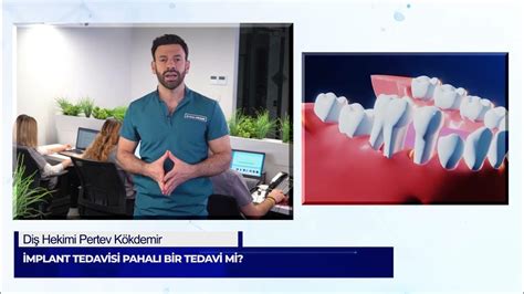 Protetik Diş Tedavisi: Sıkça Sorulan Sorular