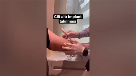 Cilt Altı İmplant Cilt Altı İmplant