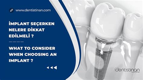 İmplant Çeşitleri İmplant Çeşitleri