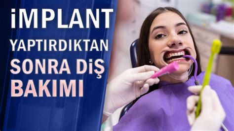 İmplant Nedir İmplant Nedir