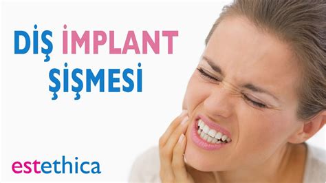 İmplant Sonrası şiş İmplant Sonrası şiş