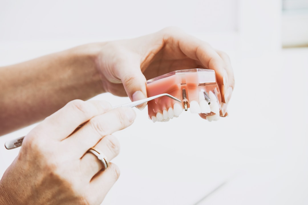 All on 4 dental implants All on 4 dental implants